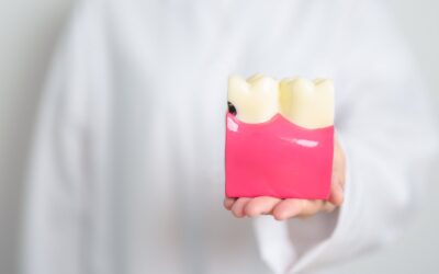 Zęby mądrości – kiedy usuwać i jakie mogą powodować problemy?